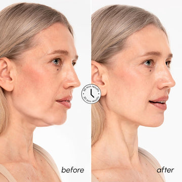 Ultimate Jawline Shaper Mask for Chin & Neck